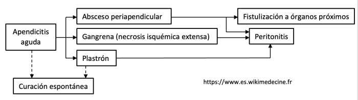 Apendicitis - evolución